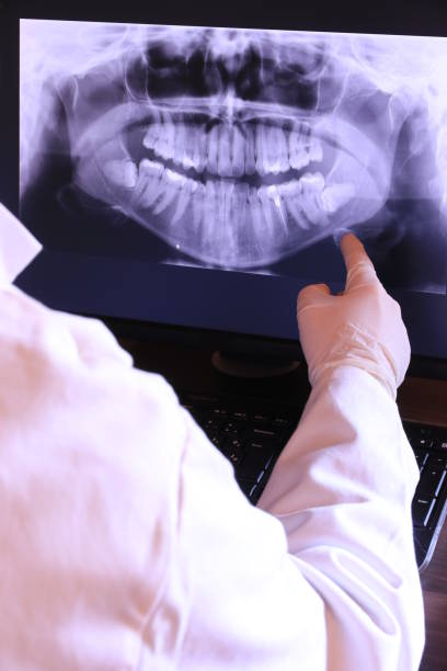 Best Broken or Cracked Tooth Emergency Dentist in Stepney, CT