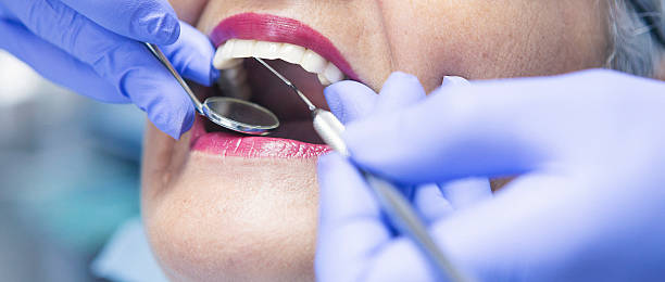 Best Emergency Dental Extractions in Stepney, CT